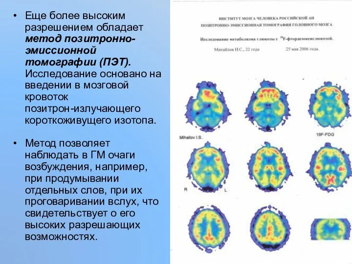 Еще более высоким разрешением обладает метод позитронно-эмиссионной томографии (ПЭТ). Исследование основано на введении