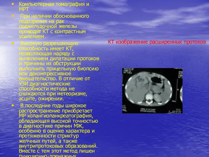 КТ изображение расширенных протоков Компьютерная томография и МРТ При наличии