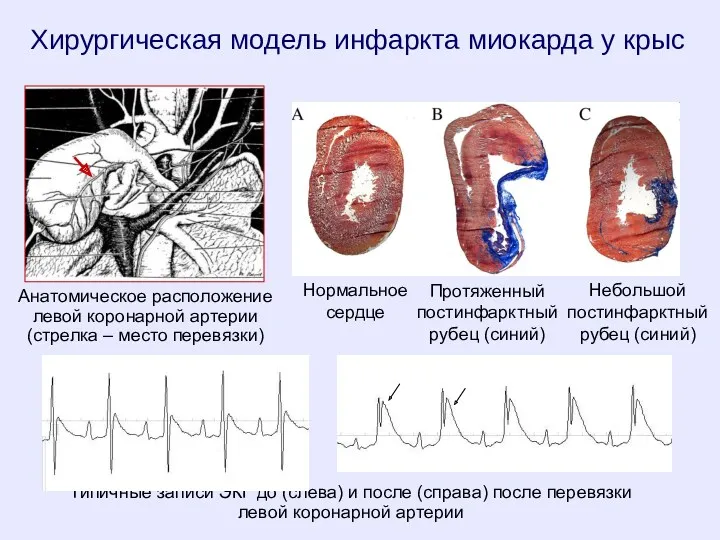 Хирургическая модель инфаркта миокарда у крыс Анатомическое расположение левой коронарной