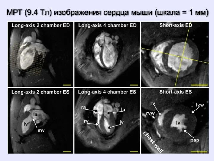 МРТ (9.4 Tл) изображения сердца мыши (шкала = 1 мм)