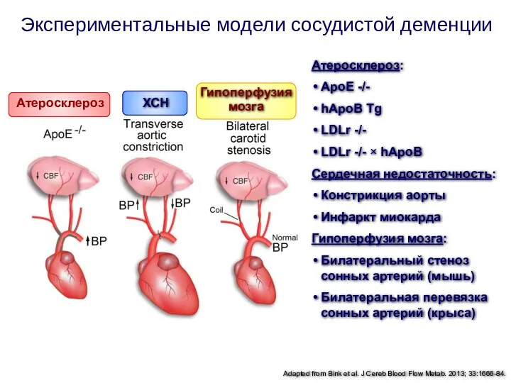 Атеросклероз: ApoE -/- hApoB Tg LDLr -/- LDLr -/- × hApoB Сердечная недостаточность: