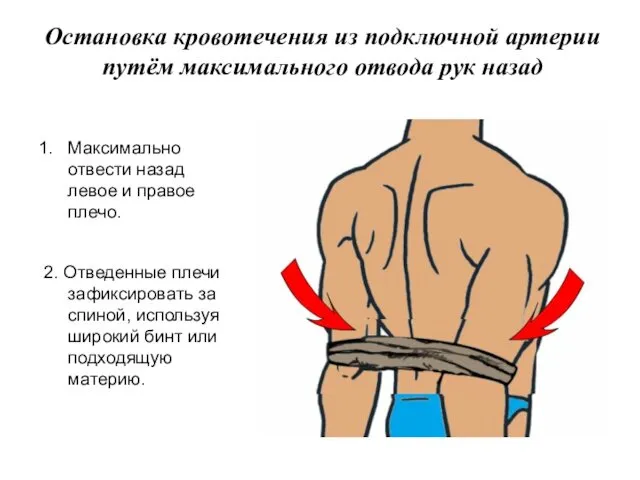 Остановка кровотечения из подключной артерии путём максимального отвода рук назад