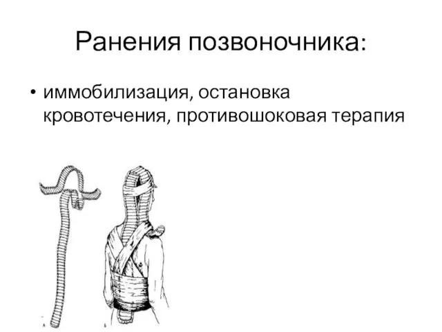 Ранения позвоночника: иммобилизация, остановка кровотечения, противошоковая терапия