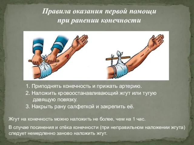 Правила оказания первой помощи при ранении конечности 1. Приподнять конечность и прижать артерию.