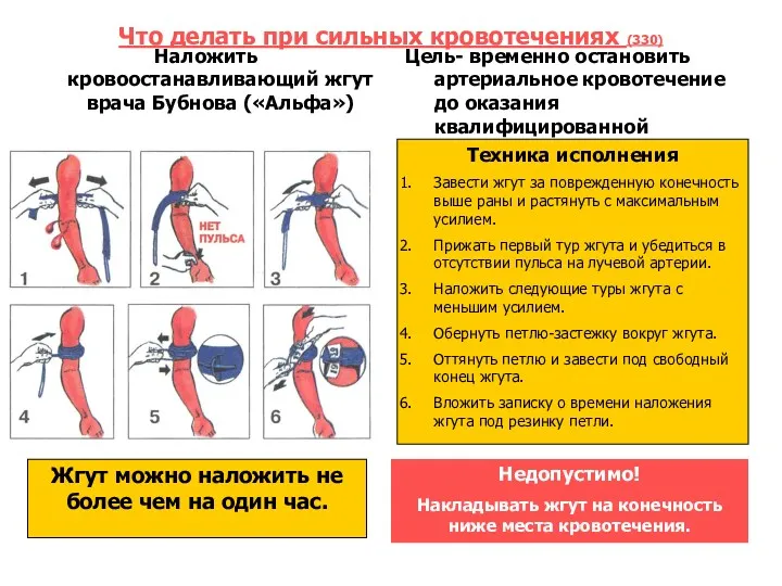 Что делать при сильных кровотечениях (330) Наложить кровоостанавливающий жгут врача