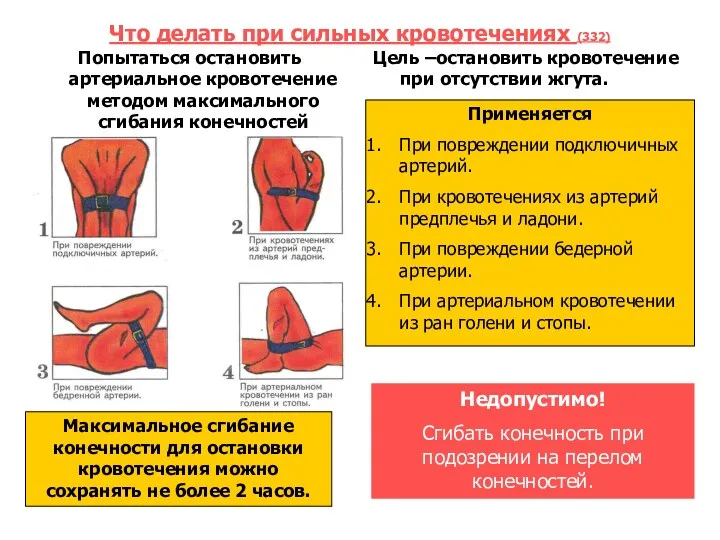 Что делать при сильных кровотечениях (332) Попытаться остановить артериальное кровотечение