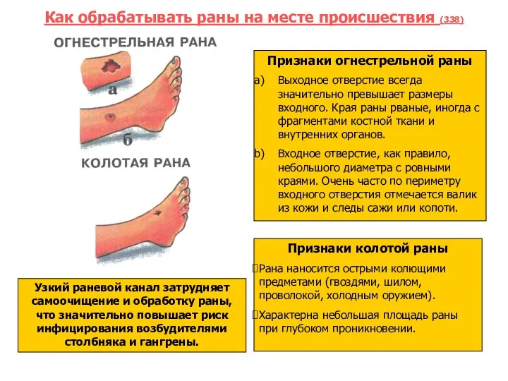 Как обрабатывать раны на месте происшествия (338) Узкий раневой канал