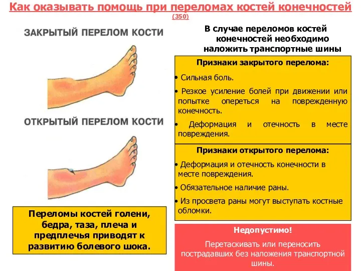 Как оказывать помощь при переломах костей конечностей (350) . В