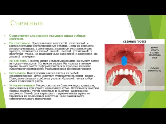 Съемные Существуют следующие съемные виды зубных протезов: Из пластмассы. Представлены