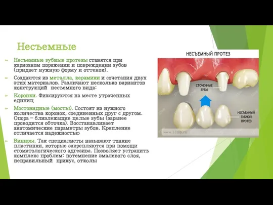 Несъемные Несъемные зубные протезы ставятся при кариозном поражении и повреждении