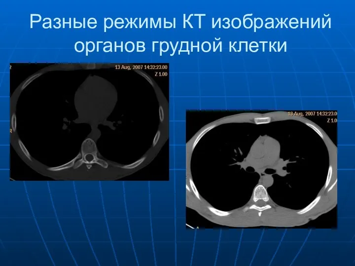 Разные режимы КТ изображений органов грудной клетки