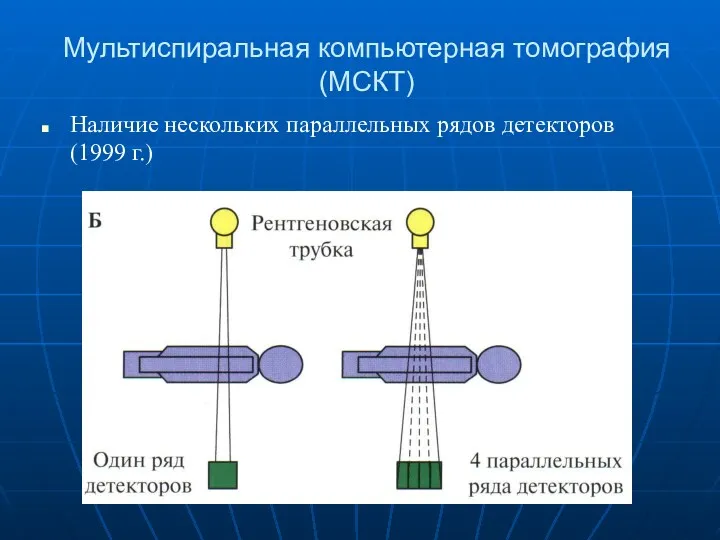 Мультиспиральная компьютерная томография (МСКТ) Наличие нескольких параллельных рядов детекторов (1999 г.)