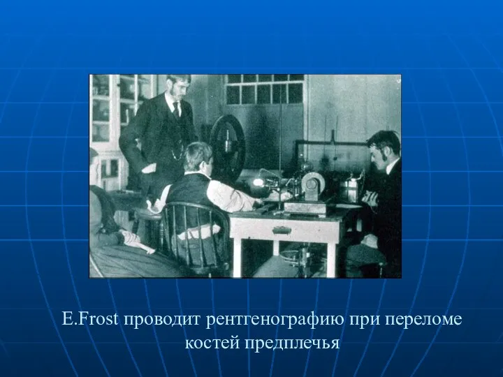 E.Frost проводит рентгенографию при переломе костей предплечья