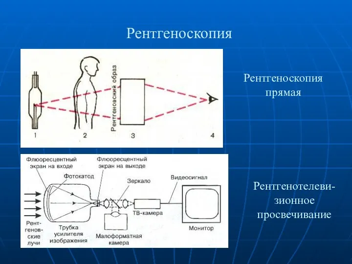 Рентгеноскопия Рентгеноскопия прямая Рентгенотелеви-зионное просвечивание