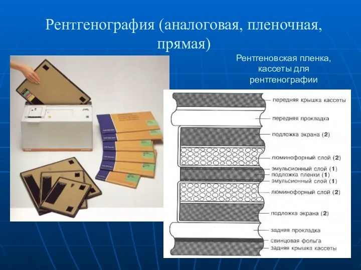 Рентгенография (аналоговая, пленочная, прямая) Рентгеновская пленка, кассеты для рентгенографии