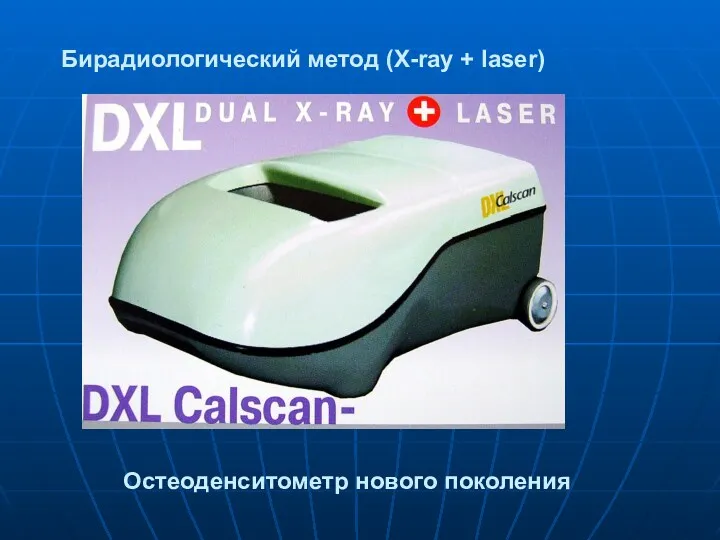 Бирадиологический метод (X-ray + laser) Остеоденситометр нового поколения