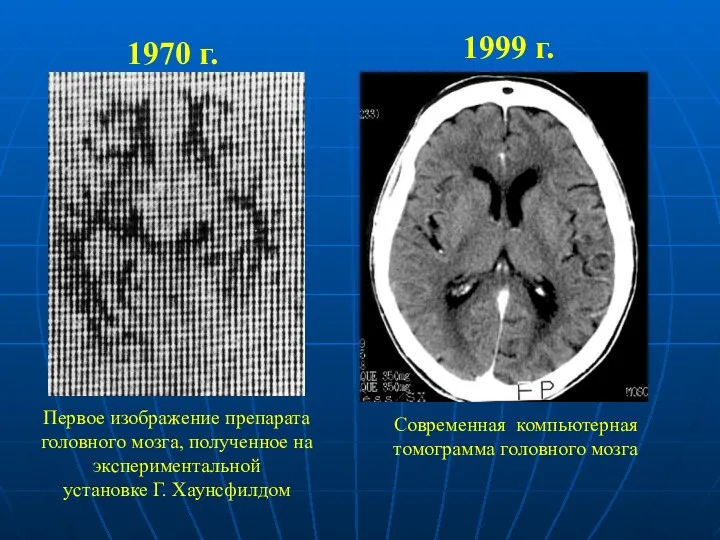 1970 г. Первое изображение препарата головного мозга, полученное на экспериментальной