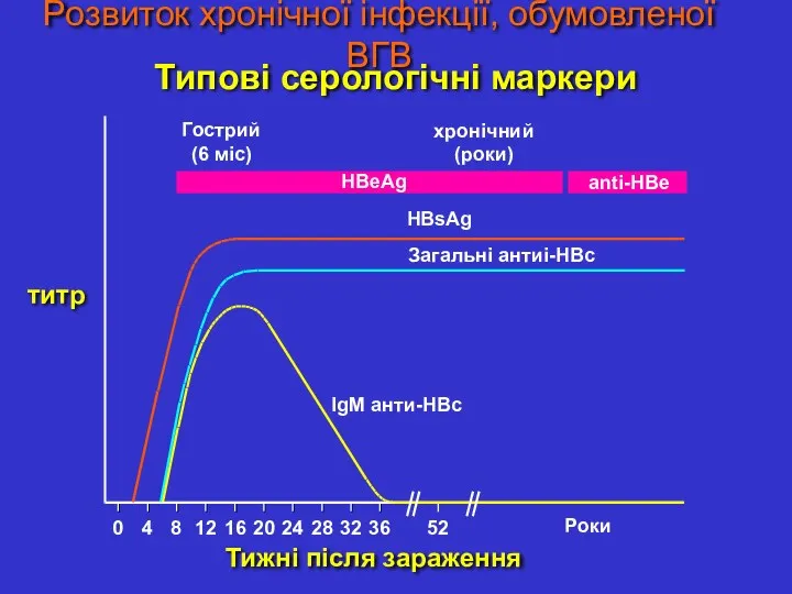 Розвиток хронічної інфекції, обумовленої ВГВ титр IgM анти-HBc Загальні антиi-HBc