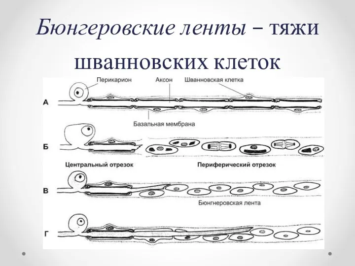 Бюнгеровские ленты – тяжи шванновских клеток