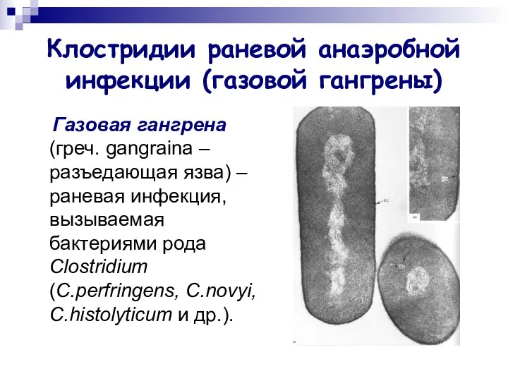 Клостридии раневой анаэробной инфекции (газовой гангрены) Газовая гангрена (греч. gangraina