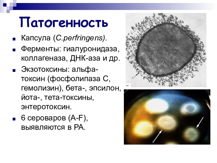 Патогенность Капсула (C.perfringens). Ферменты: гиалуронидаза, коллагеназа, ДНК-аза и др. Экзотоксины: