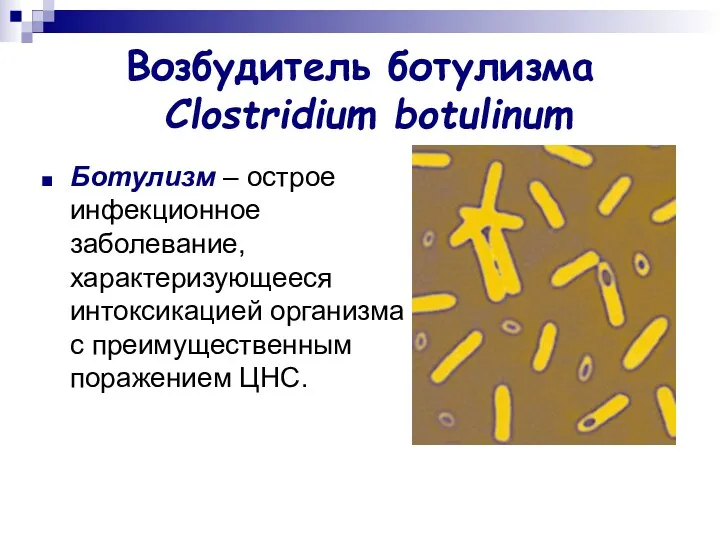 Возбудитель ботулизма Clostridium botulinum Ботулизм – острое инфекционное заболевание, характеризующееся интоксикацией организма с преимущественным поражением ЦНС.
