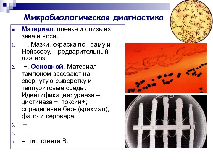 Микробиологическая диагностика Материал: пленка и слизь из зева и носа.