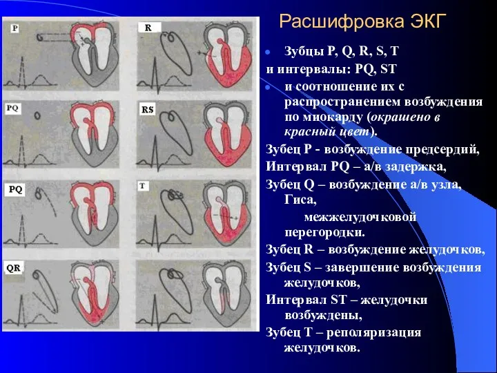 Расшифровка ЭКГ Зубцы P, Q, R, S, T и интервалы: