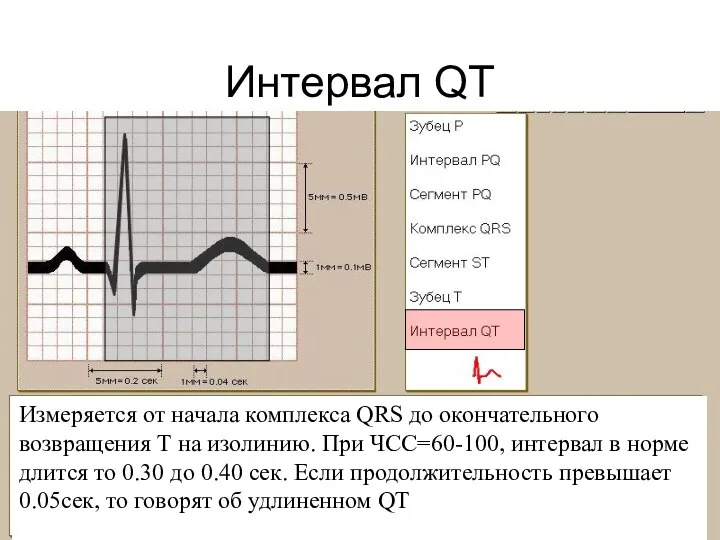 Интервал QT Измеряется от начала комплекса QRS до окончательного возвращения
