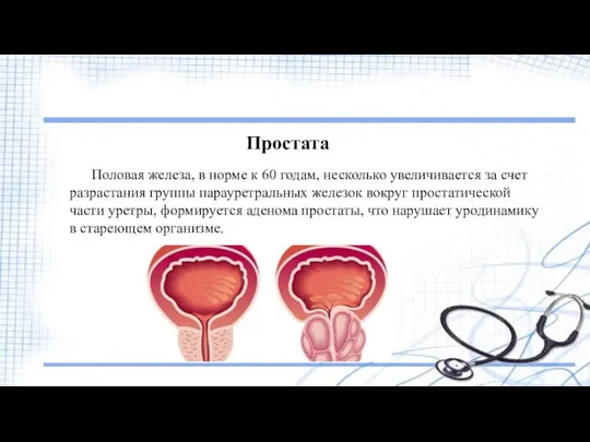 Простата Половая железа, в норме к 60 годам, несколько увеличивается