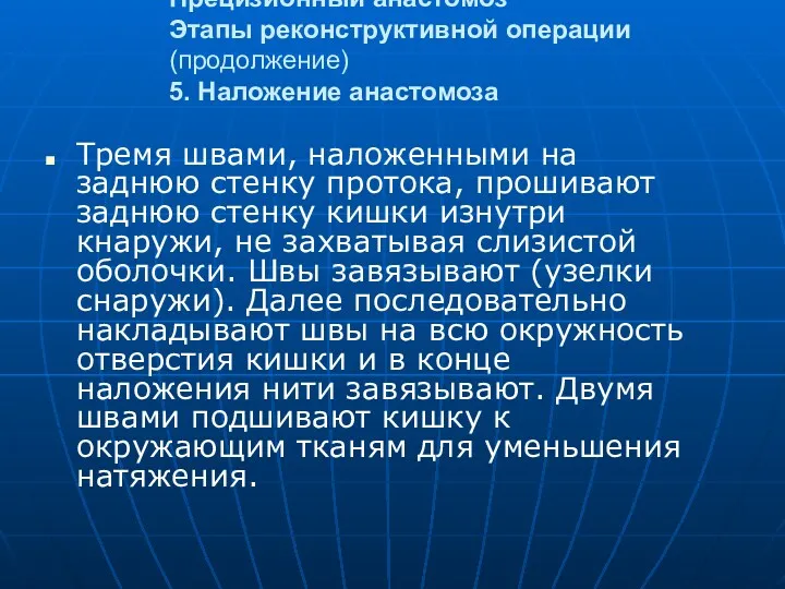 Прецизионный анастомоз Этапы реконструктивной операции (продолжение) 5. Наложение анастомоза Тремя