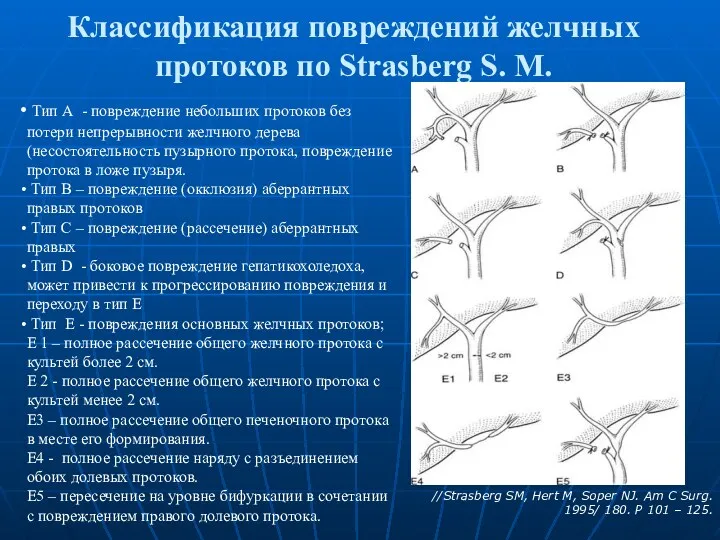 Классификация повреждений желчных протоков по Strasberg S. M. Тип А