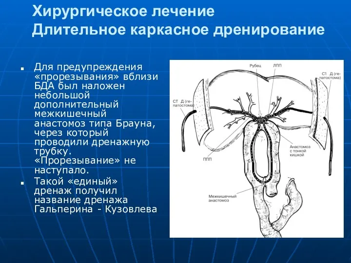 Хирургическое лечение Длительное каркасное дренирование Для предупреждения «прорезывания» вблизи БДА