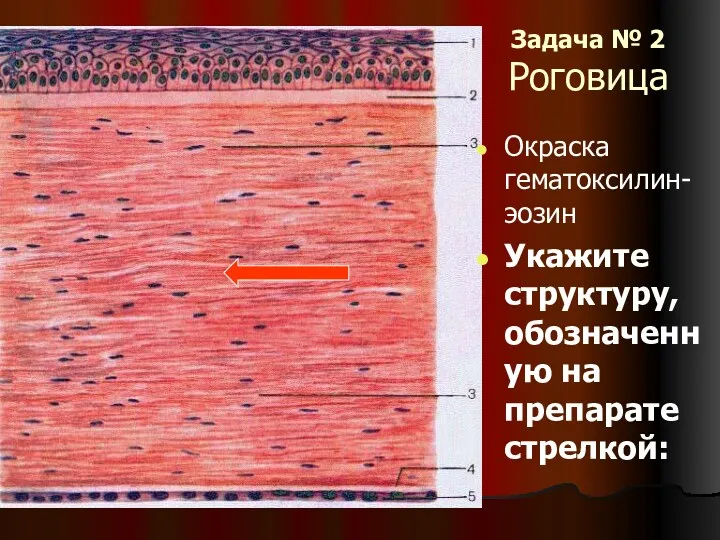 Задача № 2 Роговица Окраска гематоксилин- эозин Укажите структуру, обозначенную на препарате стрелкой: