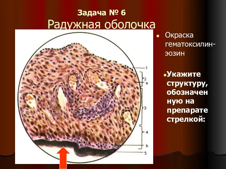 Задача № 6 Радужная оболочка Окраска гематоксилин- эозин Укажите структуру, обозначенную на препарате стрелкой: