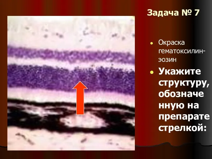 Задача № 7 Окраска гематоксилин- эозин Укажите структуру, обозначенную на препарате стрелкой: