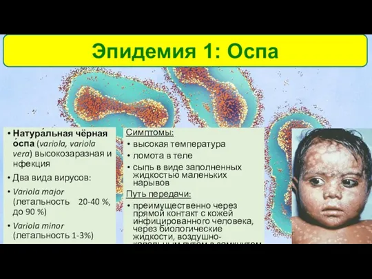 Натура́льная чёрная о́спа (variola, variola vera) высокозаразная инфекция Два вида