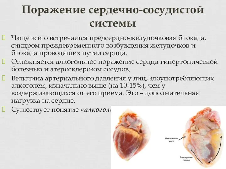 Чаще всего встречается предсердно-желудочковая блокада, синдром преждевременного возбуждения желудочков и