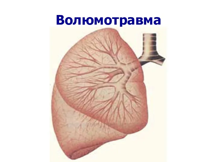 Волюмотравма