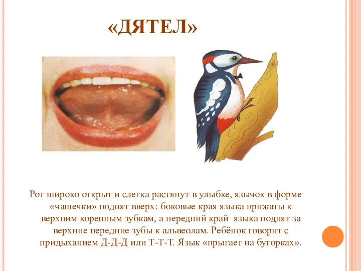 «ДЯТЕЛ» Рот широко открыт и слегка растянут в улыбке, язычок в форме «чашечки»