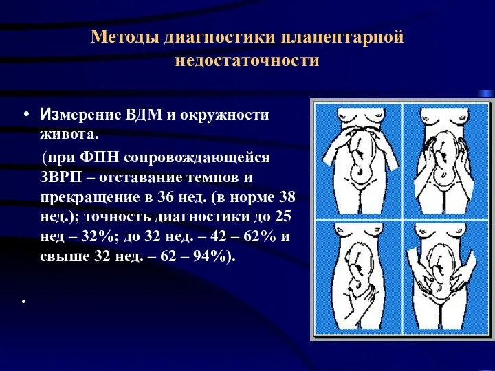 Методы диагностики плацентарной недостаточности Измерение ВДМ и окружности живота. (при