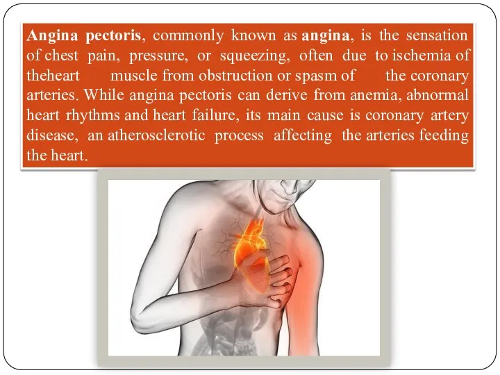 Angina pectoris, commonly known as angina, is the sensation of