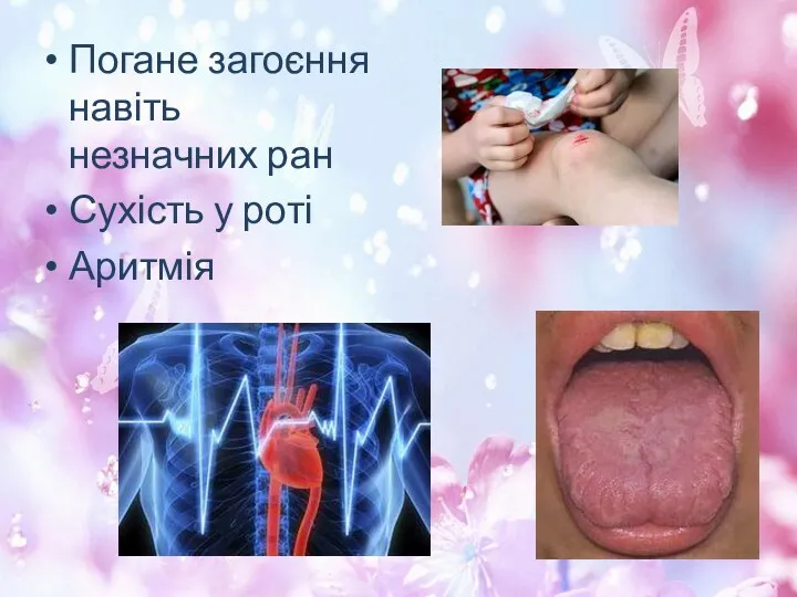 Погане загоєння навіть незначних ран Сухість у роті Аритмія
