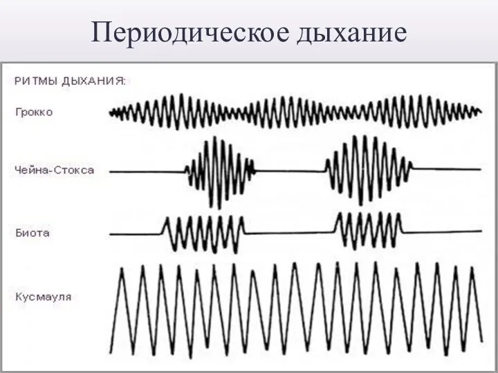 Периодическое дыхание