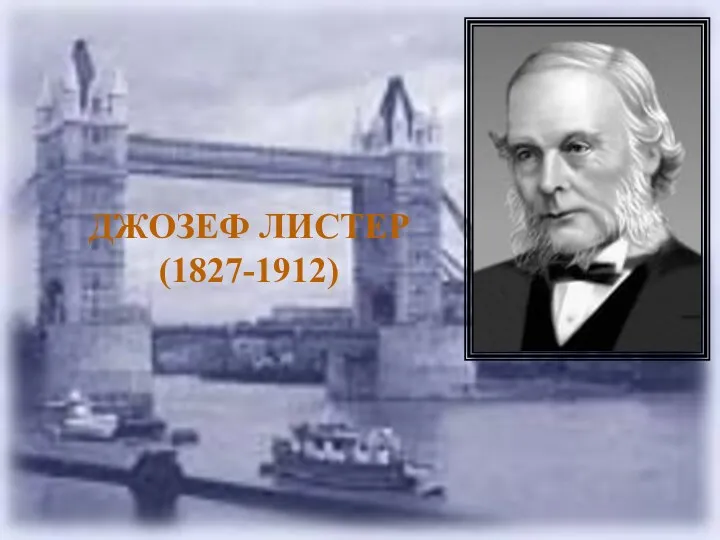 ДЖОЗЕФ ЛИСТЕР (1827-1912)
