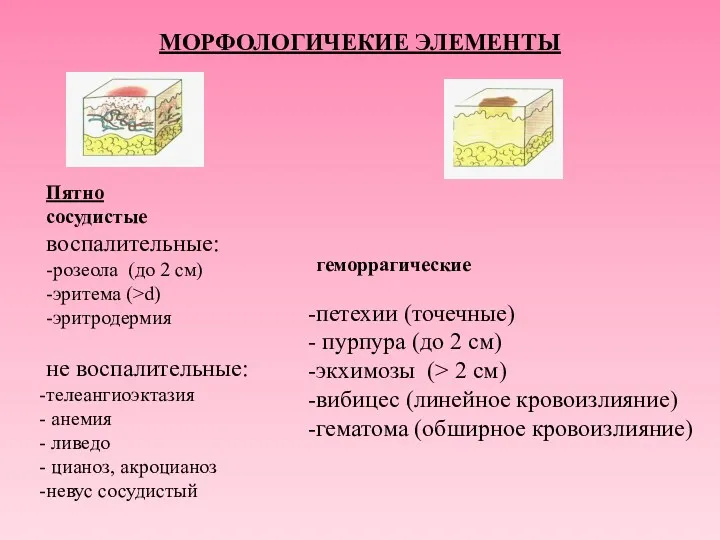 МОРФОЛОГИЧЕКИЕ ЭЛЕМЕНТЫ Пятно сосудистые воспалительные: -розеола (до 2 см) -эритема