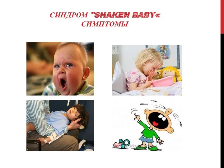СИНДРОМ "SHAKEN BABY« СИМПТОМЫ