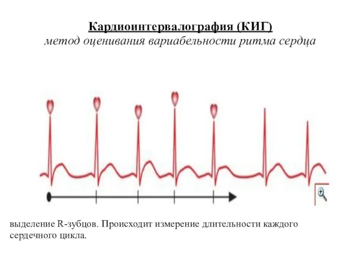 Кардиоинтервалография (КИГ) метод оценивания вариабельности ритма сердца выделение R-зубцов. Происходит измерение длительности каждого сердечного цикла.