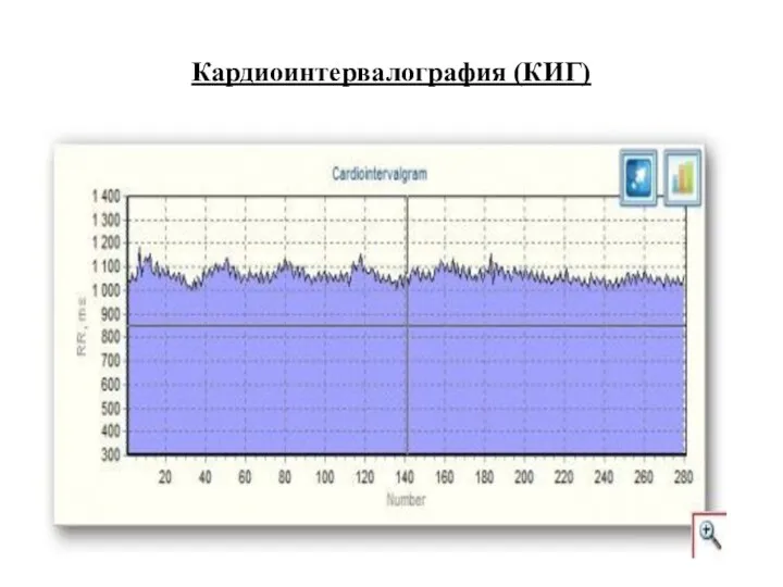 Кардиоинтервалография (КИГ)