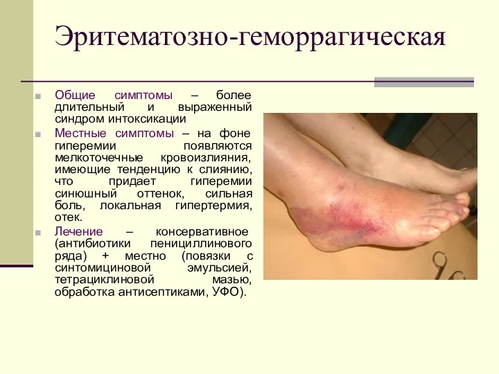 Эритематозно-геморрагическая Общие симптомы – более длительный и выраженный синдром интоксикации